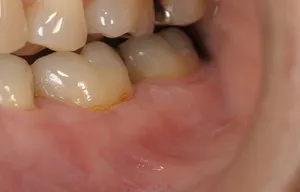 症例4