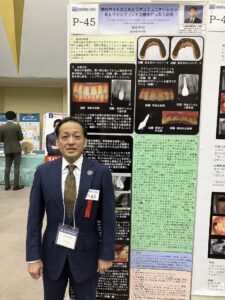 第35回日本歯科審美学会学術大会でポスター発表してきました。