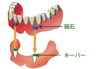 磁性アタッチメント